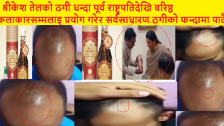 ३२ जडीबुटी युक्त श्री केश तेलको ठगी धन्दा छताछुल्ल,पूर्व राष्ट्रपतिदेखि बरिष्ठ कलाकारसम्मलाइ विज्ञापन गराएर सर्वसाधारसँग ठगी